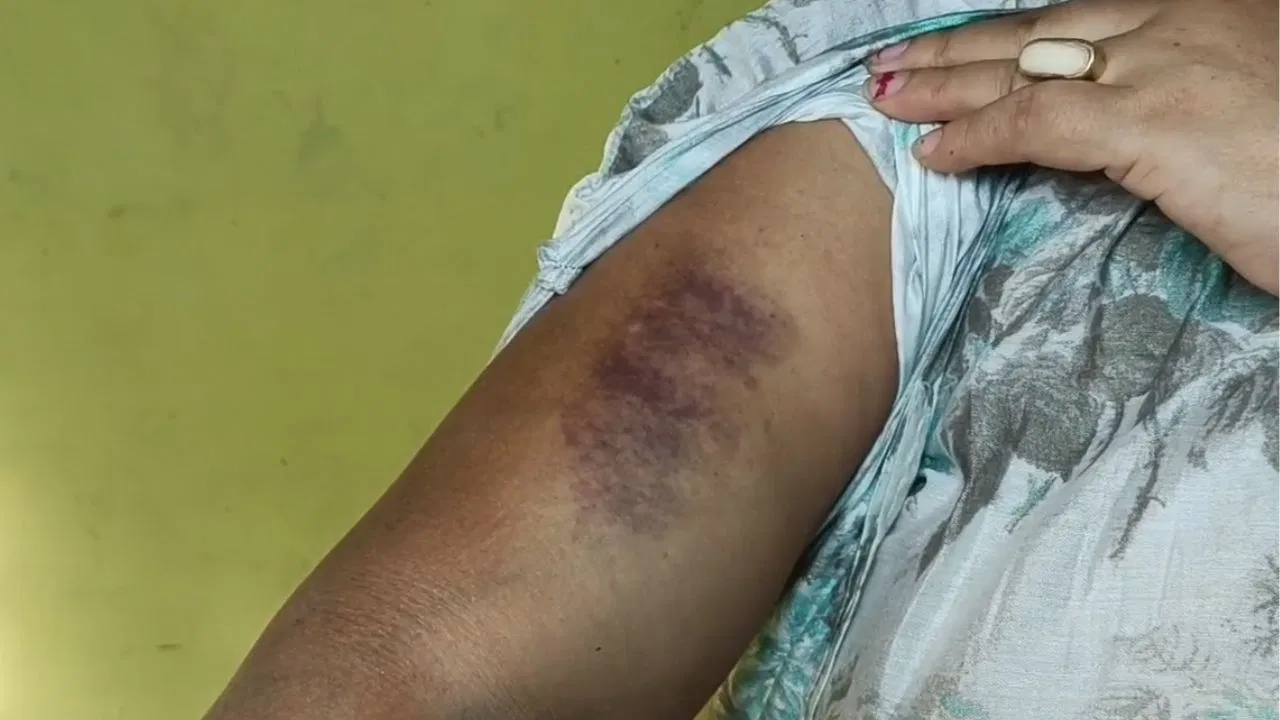 মদ্যপ অবস্থায় স্ত্রীর উপর বেধড়ক মারধরের অভিযোগ, তৃণমূল কাউন্সিলরের বিরুদ্ধে থানায় অভিযোগ দায়ের