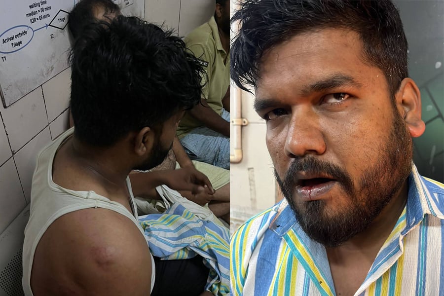 উৎসবের মরশুমে তুচ্ছ ঘটনায় উত্তপ্ত আসানসোল, বাজি ফাটানো নিয়ে সংঘর্ষে আহত ৫